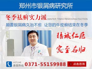 郑州牛皮癣专科医院
