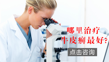 郑州市银屑病研究所是私立还是公立