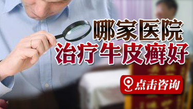 郑州牛皮癣治疗银屑病研究所权威