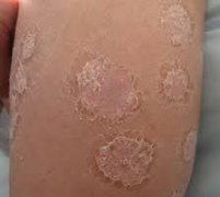 患者应该学会合理用药
